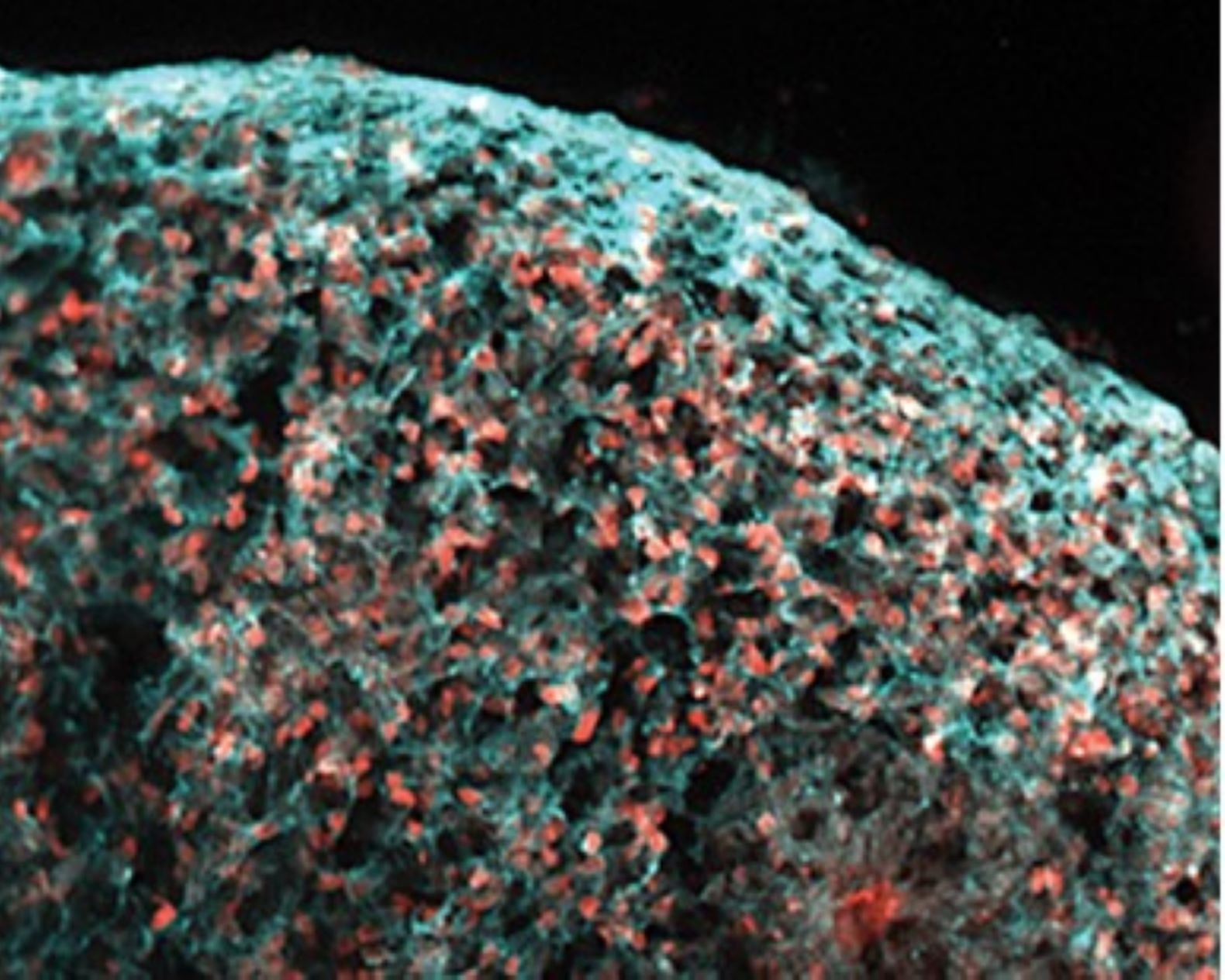 Frontotemporal Dementia in a Dish